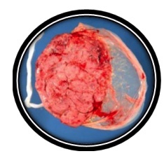 amniotic membrane tissue samples