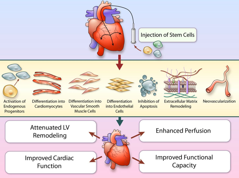  Cellular Therapy and Stem Cells for Heart Diseases: Advancements, Mechanisms, and Clinical Implications in Heart Diseases 