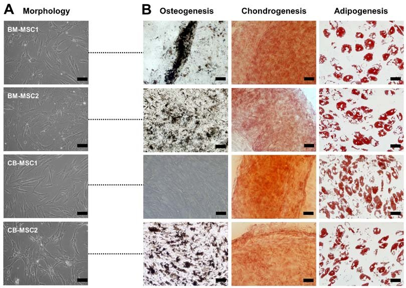 Mesenchymal Stem Cells (MSCs) are located in various tissues and play a critical role in replenishing dying cells and regenerating damaged tissues.