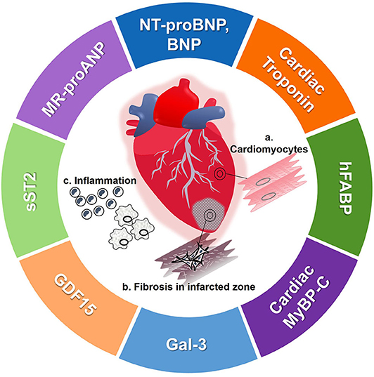  other cardiac biomarkers are used to measure the improvement of patients with heart condition