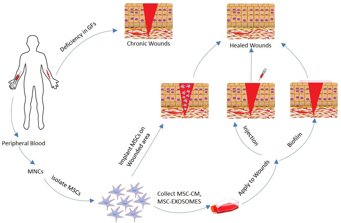 SHED cells have been found to significantly enhance wound healing compared to human fibroblasts and mesenchymal stem cell (MSC).