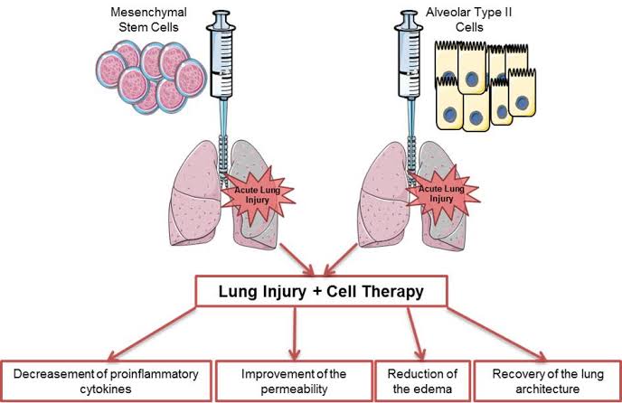 Cellular Therapy and Stem Cells for Lung Diseases with bronchi, alveolar, and lung progenitor stem cells in pulmonary diseases revolve around investigating their potential applications, mechanisms of action, and clinical implications.