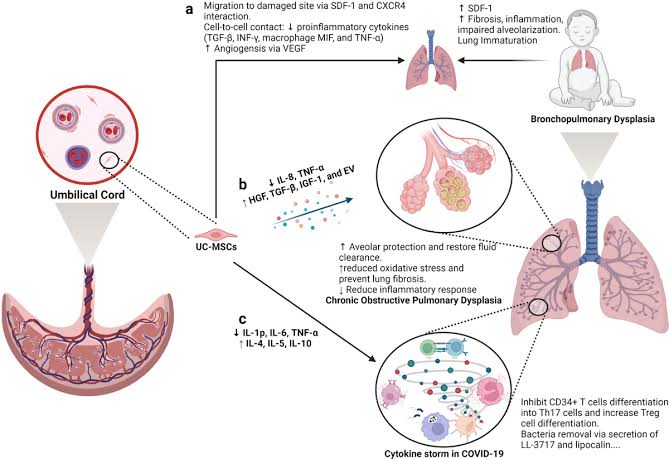 The potential applications of our specialized protocols of Cellular Therapy and Stem Cells for Lung Diseases