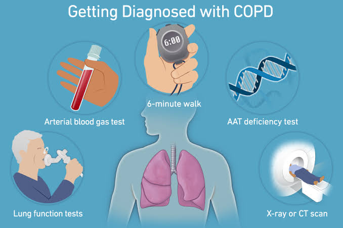 Improvement in lung conditions post-Cellular Therapy and Stem Cells for Lung Diseases is characterized by alleviation of symptoms, enhanced lung function, resolution of abnormalities on imaging, and reduced disease activity as observed through various diagnostic modalities.