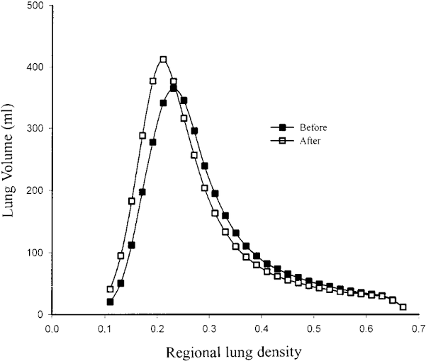 Here is a chart illustrating the changes in lung volume (LV) and pulmonary function test (PFT) before and after undergoing our Cellular Therapy and Stem Cells for Lung Diseases