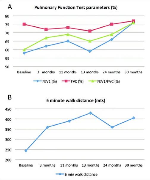 our Cellular Therapy and Stem Cells for Lung Diseases, demonstrating its effectiveness in improving lung volume and pulmonary function.