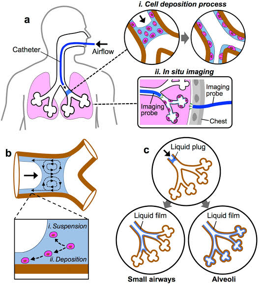 Our team of Cellular Therapy and Stem Cell Researchers continue to explore and develop innovative strategies for optimizing stem cell delivery to the lungs for therapeutic purposes.