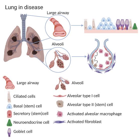 In this exploration of the lungs, Cellular Therapy and Stem Cells for Lung Diseases, we draw inspiration from nature's wonders and harness the power of regenerative biology to confront the challenges of respiratory disease.