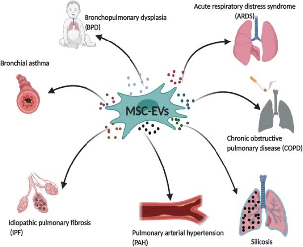 Lung or pulmonary diseases significantly impact global health, presenting varying prevalence, morbidity, mortality, and economic burden