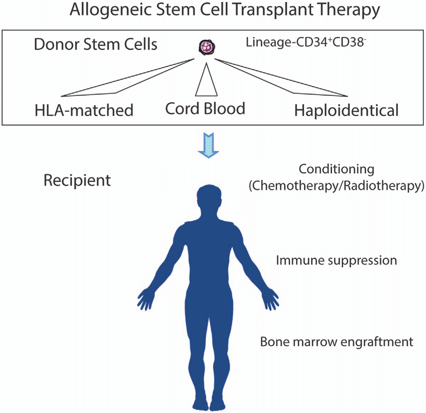 Haploidentical Transplantation: Advances have allowed for successful transplants even with partial HLA matching (haploidentical), where the donor is a half-match, usually a parent or child.