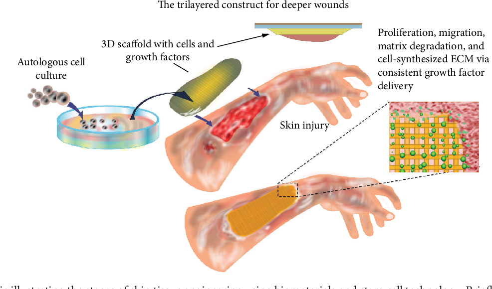 Skin wounds: Skin Cellular Therapy and Stem Cells are used to grow skin grafts for patients with severe burns or chronic wounds.