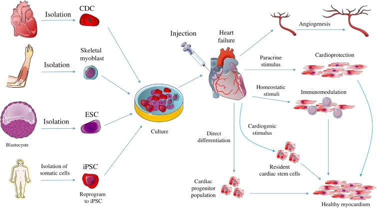 Revolutionary Cellular Therapy and Stem Cells for Heart Diseases : Harnessing the Potential of Endothelial and Cardiac Progenitor Stem Cells