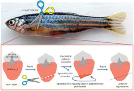 One area of promising exploration lies in Cellular Therapy and Stem Cells for Heart Disease Regeneration. 