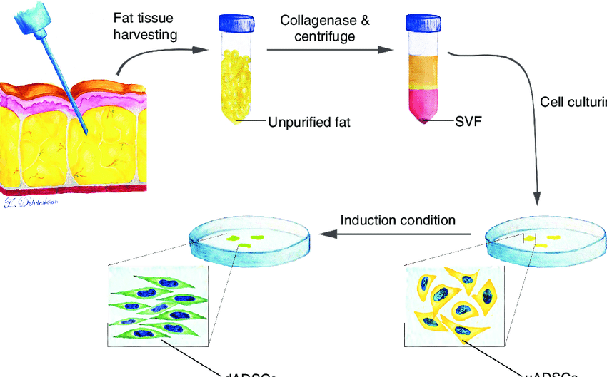 Adipose-derived stem cells (ADSCs) are a type of mesenchymal stem cell (MSC) that can be isolated from adipose (fat) tissue. 