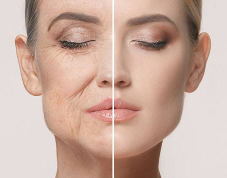 Anti-aging encompasses various strategies aimed at slowing the aging process and improving overall health and appearance.