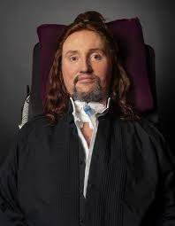  Jason Becker: Exceptional guitarist and composer who was diagnosed with ALS at a young age but continues to create music using eye-tracking technology. 