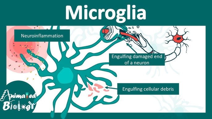 In ALS, activated microglia contribute to neuroinflammation and may exacerbate neuronal damage. 