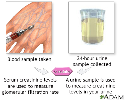 Creatinine is a waste product formed from the normal breakdown of muscle tissue. It is produced at a relatively constant rate by the body, depending on muscle mass, and is primarily excreted by the kidneys. Measuring creatinine levels in the blood and urine is crucial for assessing kidney function.