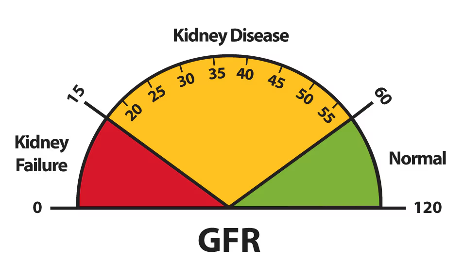 The Glomerular Filtration Rate (GFR) is a critical measure of kidney function that estimates how much blood is filtered by the glomeruli (the tiny filters in the kidneys) each minute.