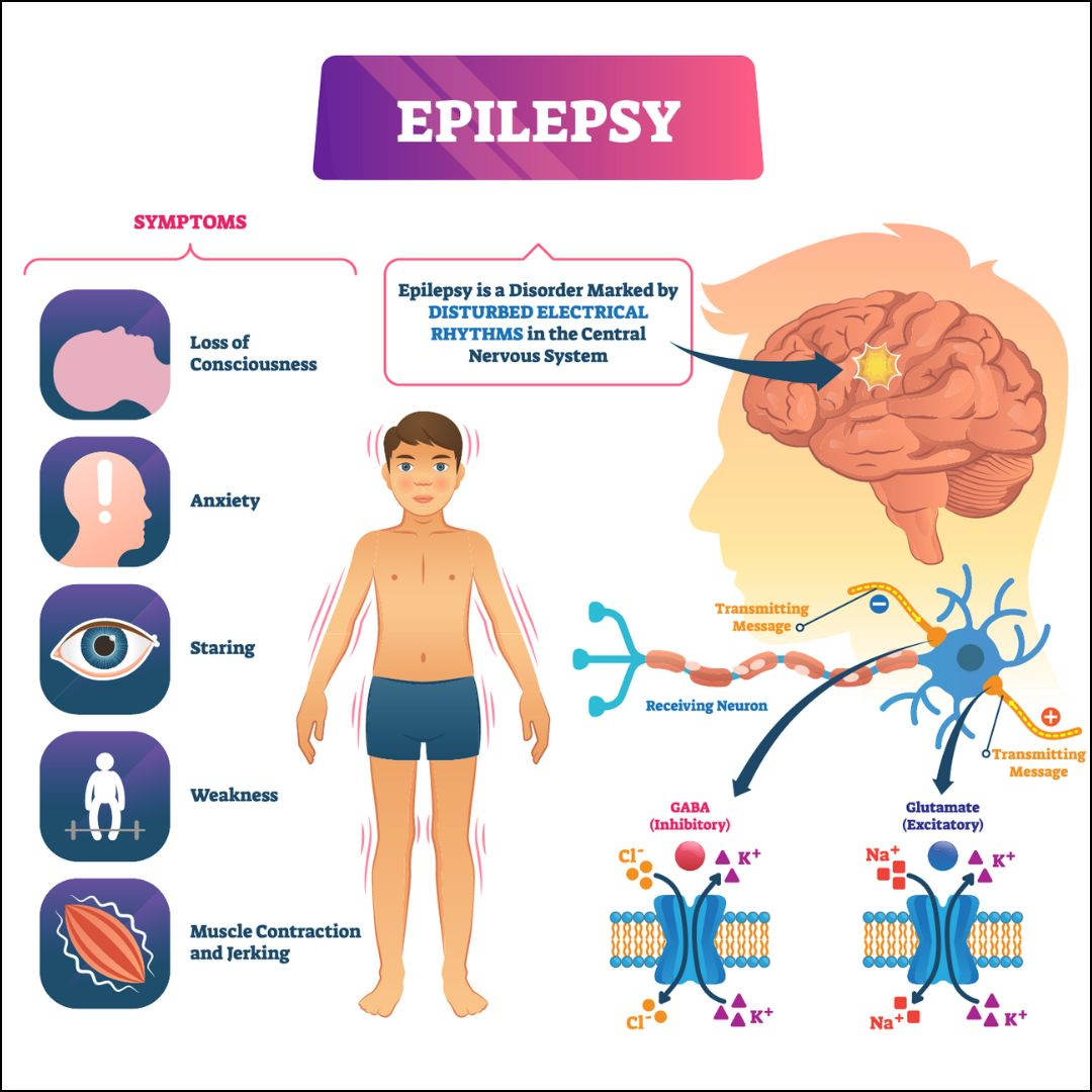 Cellular Therapy and Stem Cells for Brain, Spinal Cord and Neurodegenerative Diseases : Epilepsy