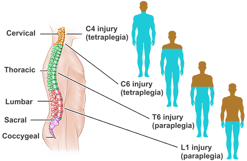 Cellular Therapy and Stem Cells for Brain, Spinal Cord and Neurodegenerative Diseases :  Spinal Cord Injury