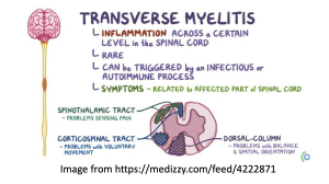 Cellular Therapy and Stem Cells for Brain, Spinal Cord and Neurodegenerative Diseases :  Transverse Myelitis (TM)