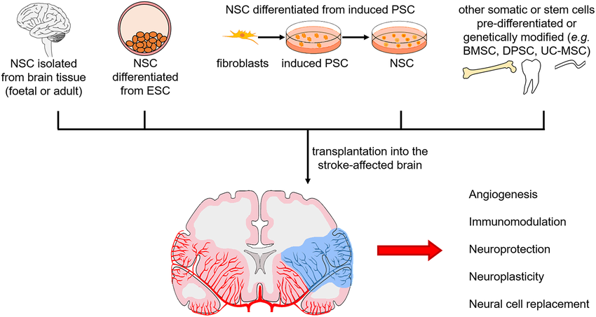 The sources of neural stem cells for transplantation as part of our Cellular Therapy and Stem Cells for Brain, Spinal Cord and Neurodegenerative Diseases