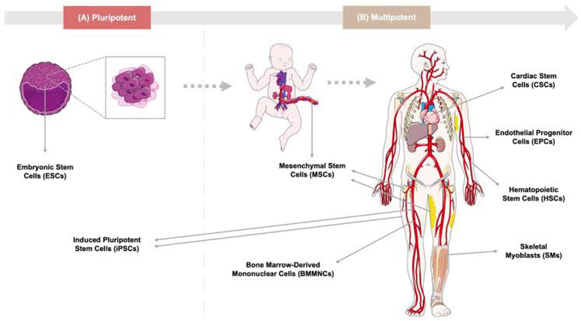  Sources of Allogenic Cellular Therapy and Progenitor Stem Cells for CAD/ACS/MI/Heart Attack/IHD