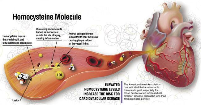 Homocysteine is a sulfur-containing amino acid produced in the body during the metabolism of methionine, an essential amino acid obtained from dietary protein.