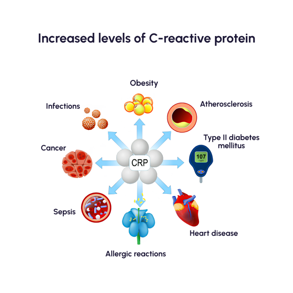 C-reactive protein (CRP) is a substance produced by the liver in response to inflammation.