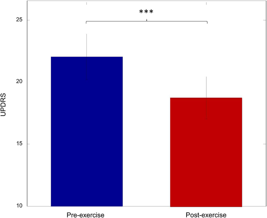 Pre and Post Treatment Outcomes of Our International Patient with Parkinson’s Disease After our special treatment protocols of Cellular Therapy and Stem Cells for Parkinson's Disease