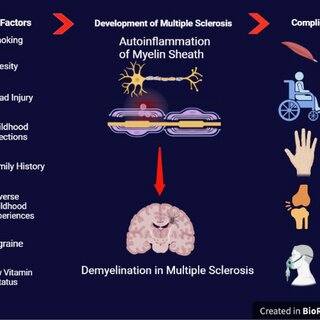 Multiple Sclerosis (MS) is a multifactorial autoimmune disorder with a complex interplay between genetic predisposition and environmental triggers. 