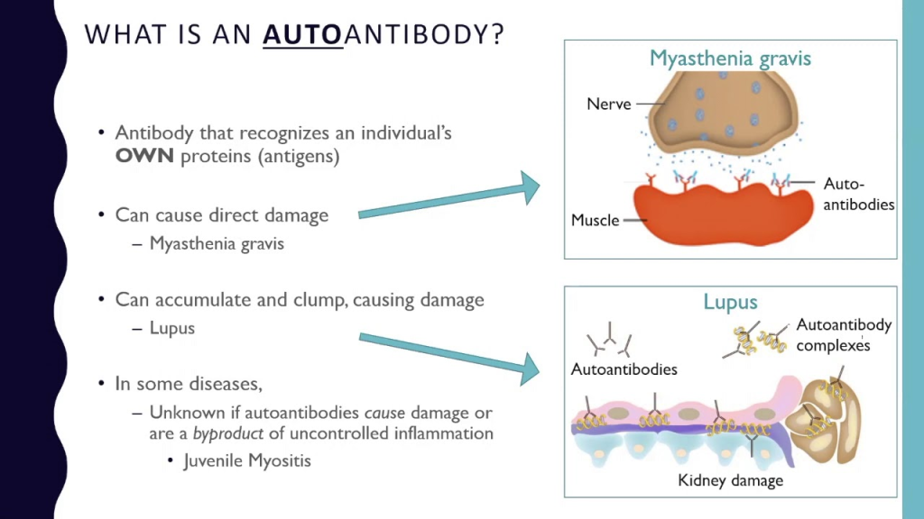 Autoantibodies (AA) are antibodies produced by the immune system that mistakenly target and attack the body's own cells, tissues, or proteins. 