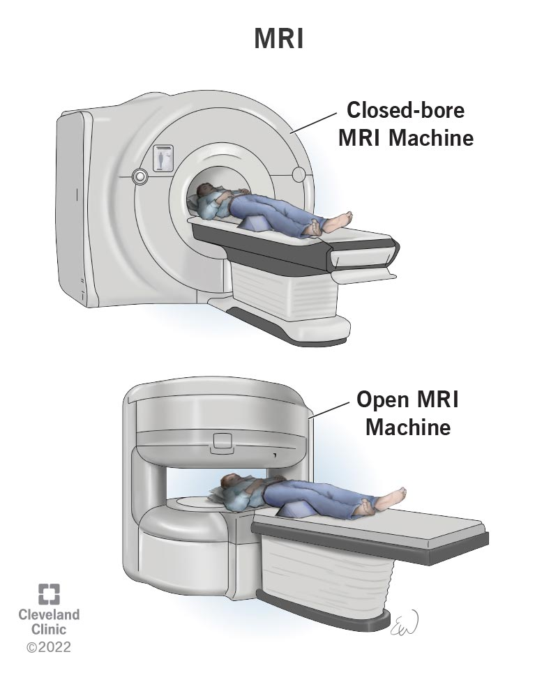 Magnetic Resonance Imaging (MRI) is a non-invasive diagnostic imaging technique that uses powerful magnets and radio waves to generate detailed images of the internal structures of the body.