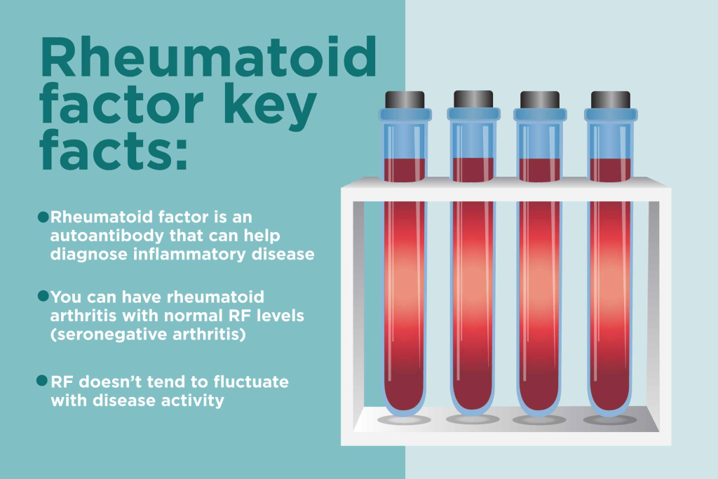 Rheumatoid factor (RF) is an autoantibody that targets the Fc portion of immunoglobulin G (IgG). 