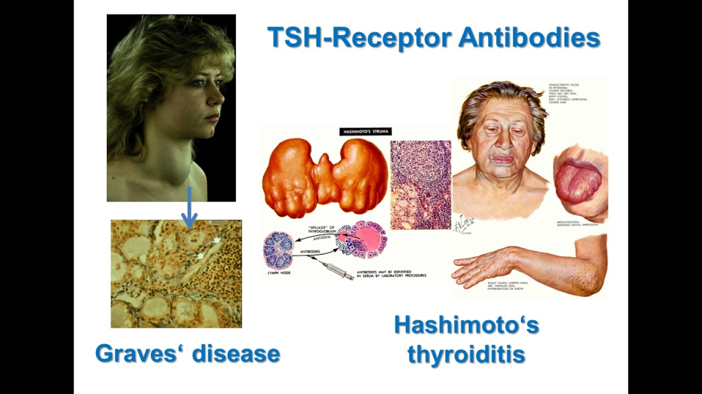 Thyroid-stimulating hormone receptor antibodies (TRAb) are autoantibodies that target the thyroid-stimulating hormone (TSH) receptor. 