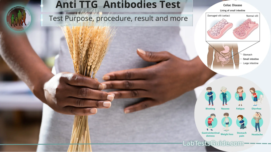 Anti-tissue transglutaminase (anti-tTG) antibodies are autoantibodies that target tissue transglutaminase, an enzyme involved in the deamidation of gluten proteins.