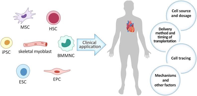 Cellular Therapy and Stem Cells for CAD and ACS