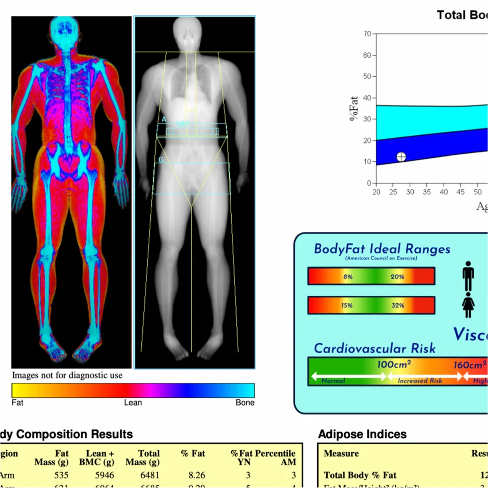 A DEXA scan (DEXS), or dual-energy X-ray absorptiometry scan, is a medical imaging technique primarily used to measure bone mineral density (BMD).