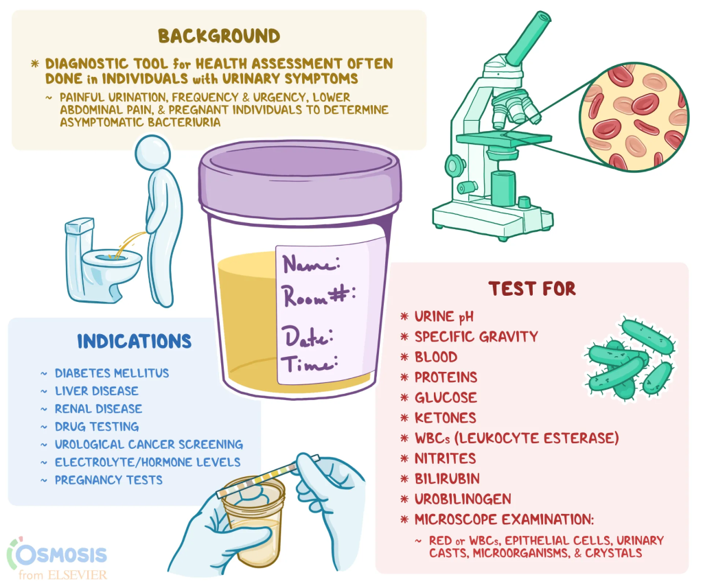 Urinalysis (U/A) is a comprehensive laboratory test that examines urine to assess various aspects of health, diagnose medical conditions, and monitor ongoing health issues. 