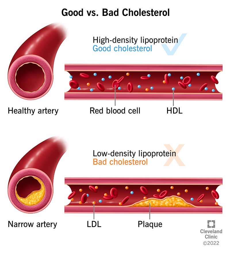 Cholesterol (TC) is a waxy, fat-like substance found in every cell of the body. It is essential for the formation of cell membranes, certain hormones, and vitamin D. 