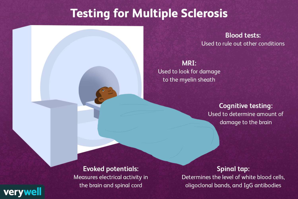 Diagnosis of Multiple Sclerosis (MS) involves a combination of clinical evaluations, imaging, and laboratory tests. 