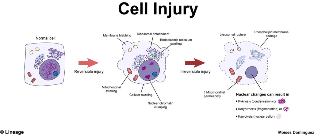 Cellular damage refers to the injury or dysfunction of cells caused by various factors, including environmental stressors, toxins, infections, and metabolic disturbances.