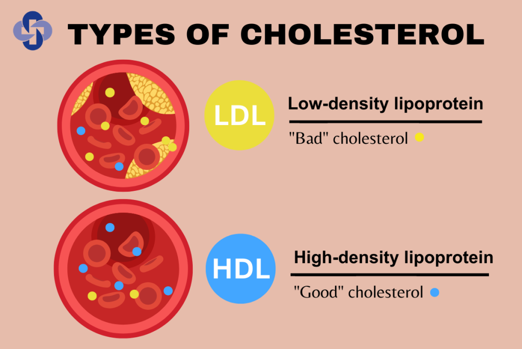 High-Density Lipoprotein (HDL) cholesterol, often termed "good" cholesterol, plays a crucial role in maintaining cardiovascular health. 