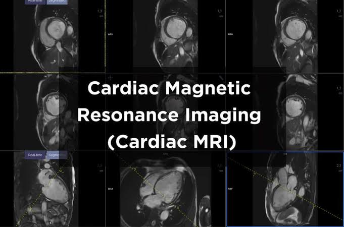 Cardiac Magnetic Resonance Imaging (CMR) is a non-invasive imaging technique that utilizes magnetic fields and radio waves to produce detailed images of the heart's structure and function.