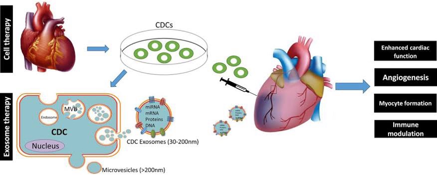 Patients with coronary artery disease (CAD), myocardial infarction (MI), and acute coronary syndrome (ACS) can benefit substantially from our Cellular Therapy and Stem Cell treatments, complemented by Exosomes. 