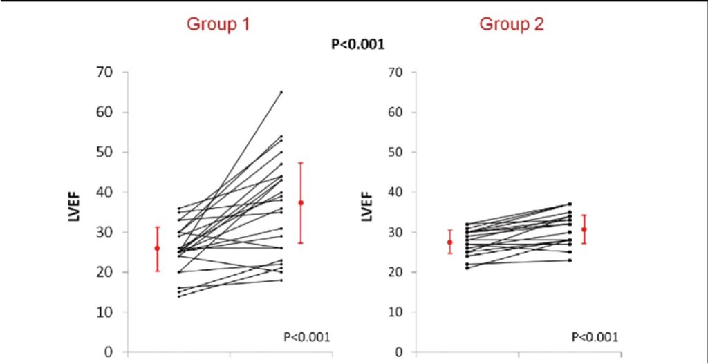 Promising Outcomes in Treating Acute Coronary Syndrome (ACS) and Coronary Artery Syndrome (CAS)