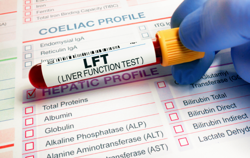 Liver function tests (LFTs), also known as hepatic panels, are a series of blood tests that provide valuable information about the state of a patient's liver.