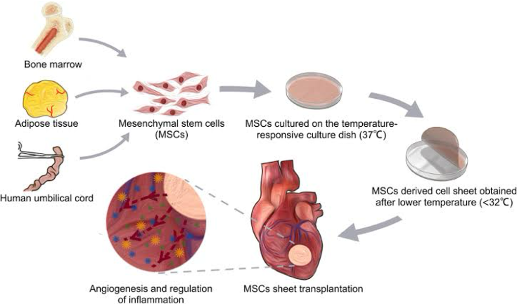 Our specialized protocols of Cellular Therapy and Stem Cells for CAD/ACS, particularly utilizing Mesenchymal Stem Cells (MSCs), are designed to effectively tone down the overactivity of fibroblasts and immune cells in patients with Acute Coronary Syndrome (ACS) and Coronary Artery Disease (CAD). 