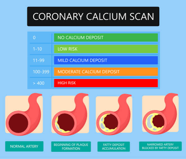 Coronary artery calcium (CAC) scoring is a valuable tool used by our team of cardiologists and regenerative specialists at our center of Anti-Aging and Regenerative Medicine Center of Thailand  for assessing cardiovascular risk